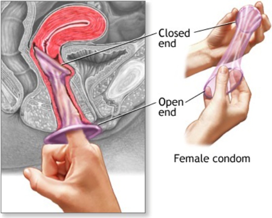 Bao cao su nữ Female Condom